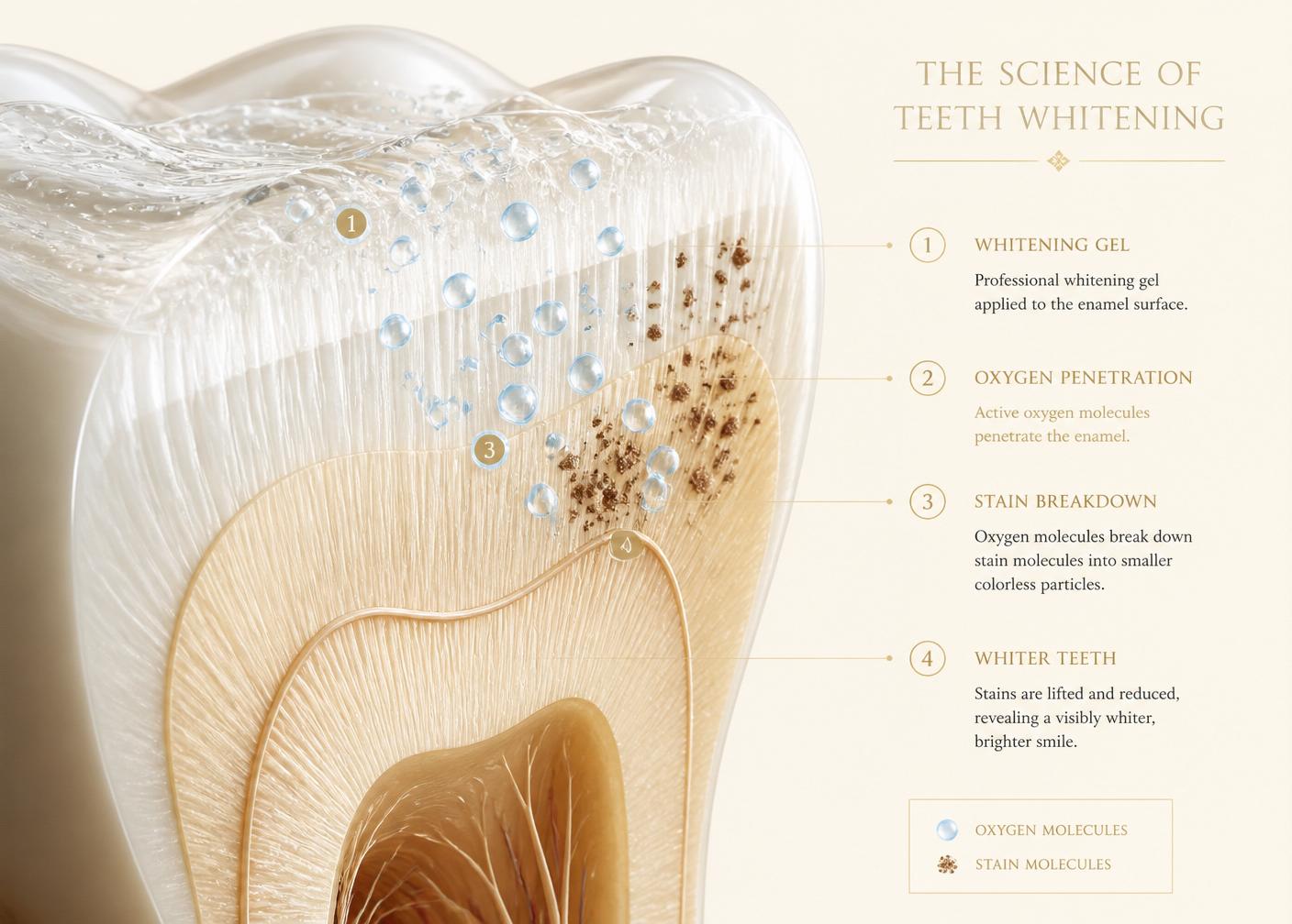 Illustration showing enamel, dentine and whitening gel penetrating the tooth to break down stain molecules