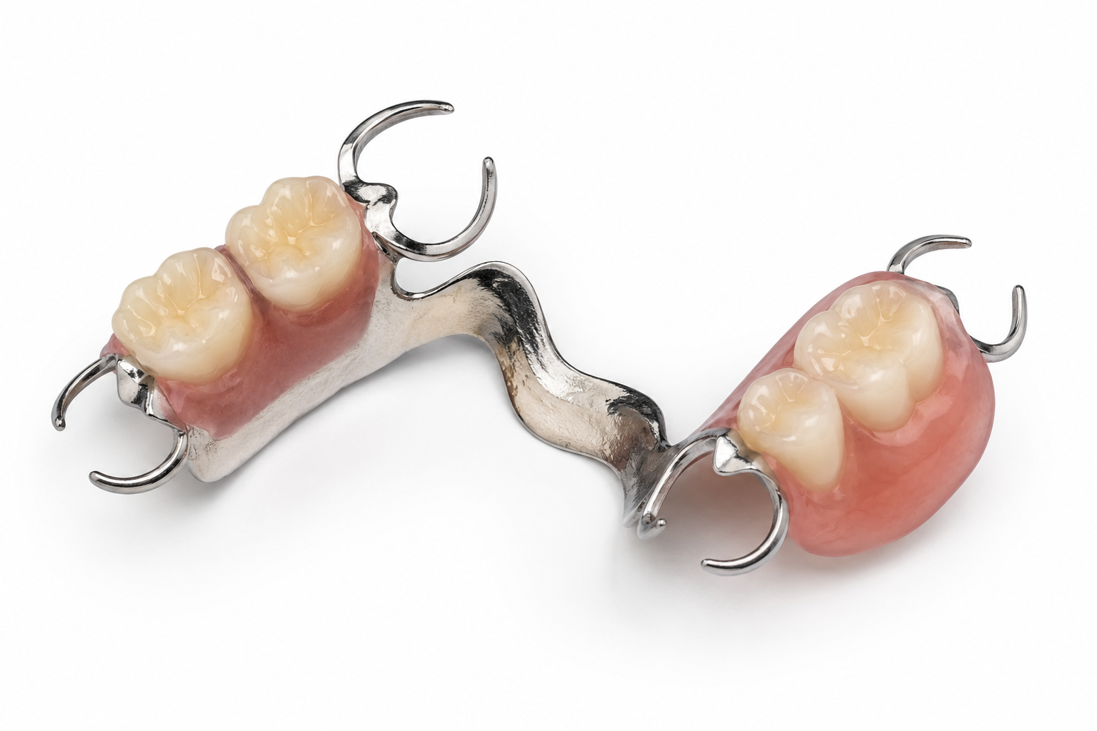 Cobalt chrome partial denture with a polished metal framework and white teeth